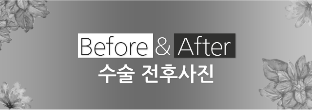 ���� ���� ����