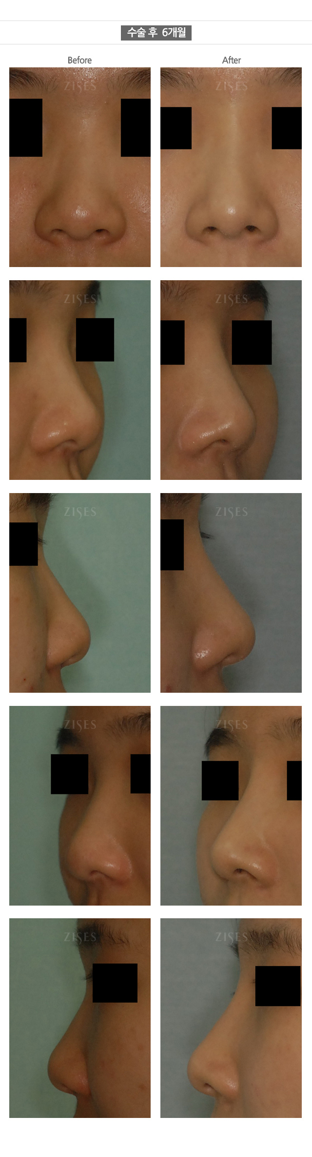 �ڼ������Ļ���