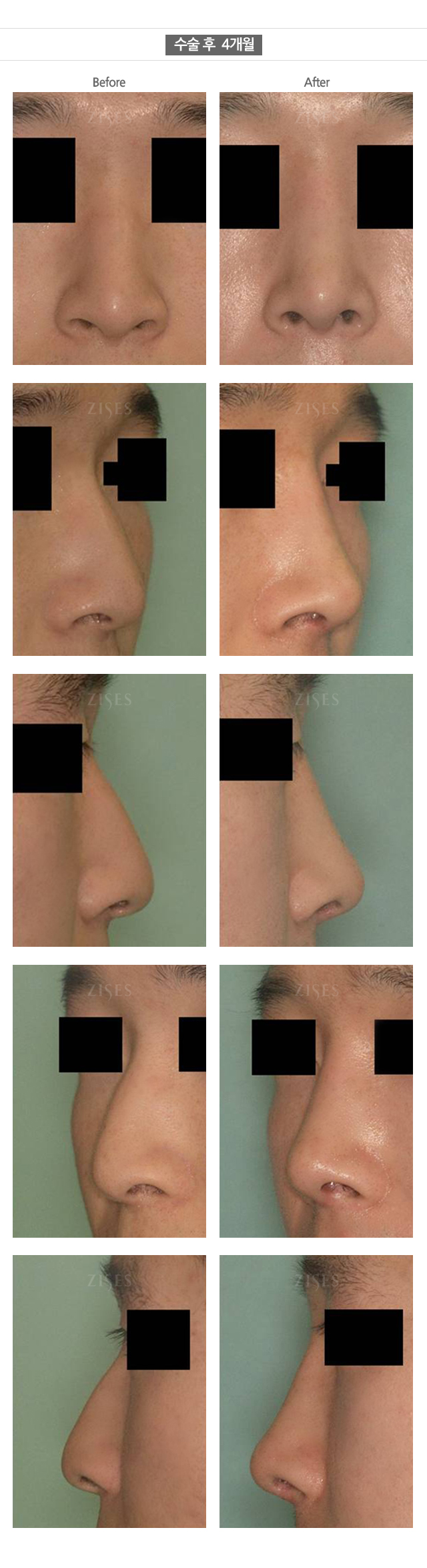 �ڼ������Ļ���